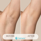 3 in 1 IPL Laser Hair Removal Device Ice Cooling, Skin Rejuvenation & Acne Treatment